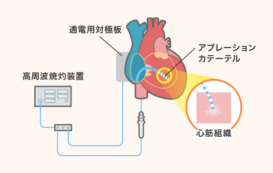 心不全 ストア 手帳 大塚 製薬